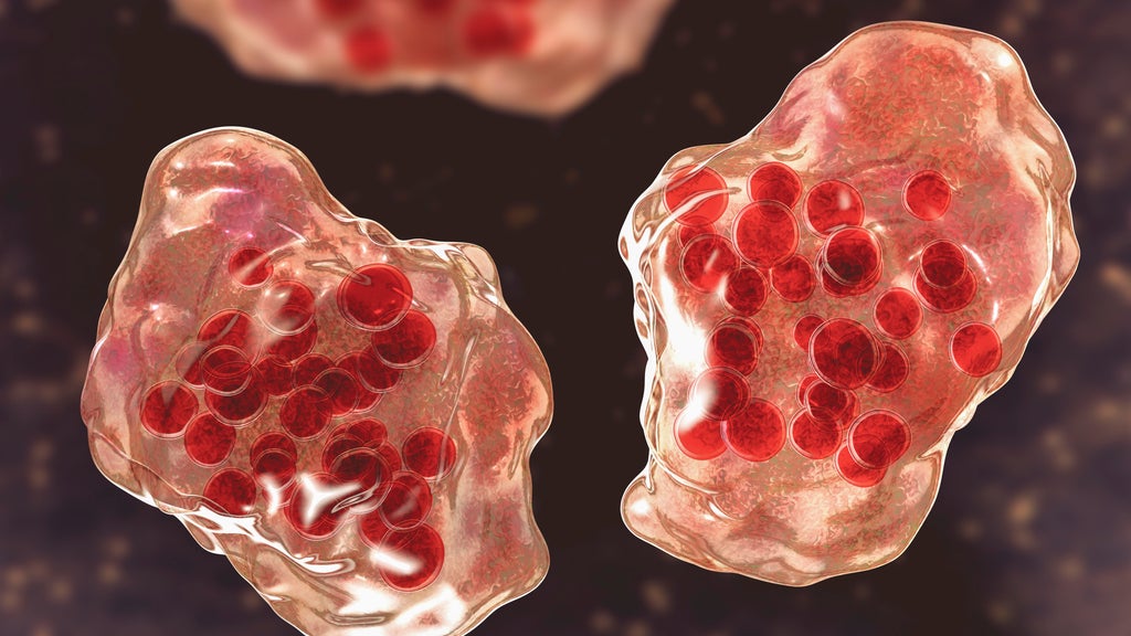 Central Minnesota county reports "several cases of suspected measles" — WCCO / CBS Minnesota, Prior Lake Health news