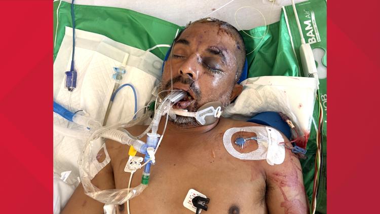 University Hospital asks for help identifying unconscious patient hit by truck Saturday evening — KENS 5 (San Antonio), Prior Lake Health news