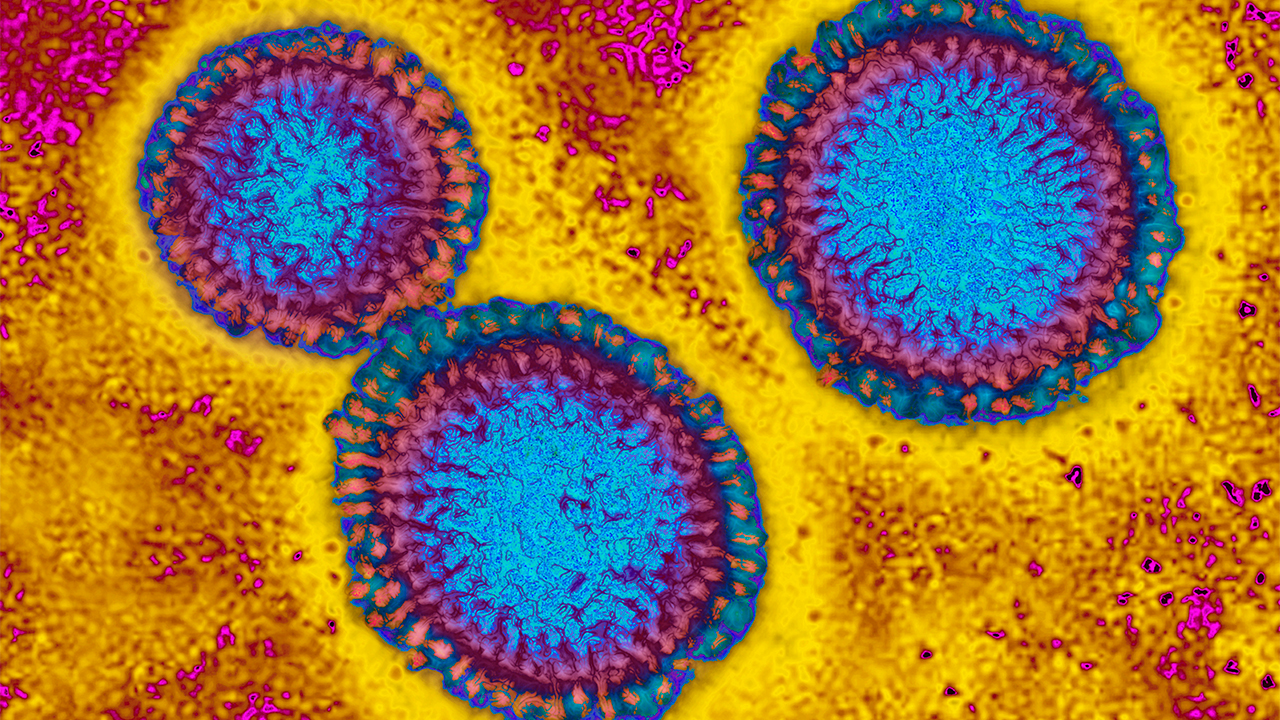 Flu hospitalizations 'slightly higher' than usual, officials urge vaccinations — FOX 9, Prior Lake Health news
